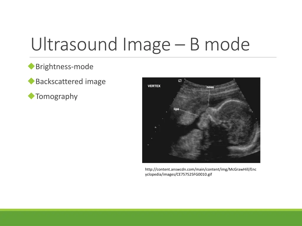 ultrasound image b mode