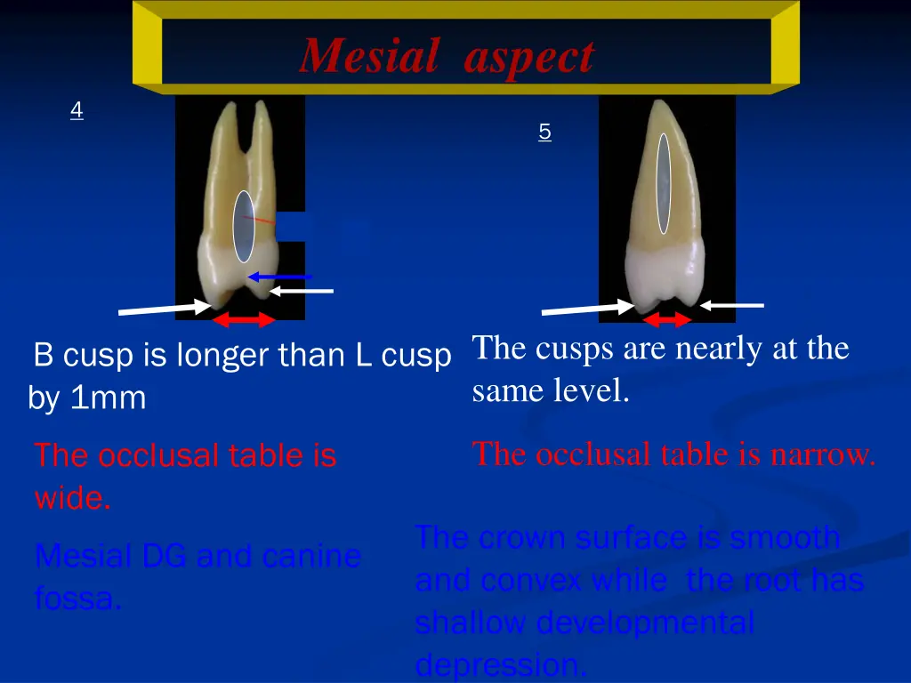 mesial aspect 1