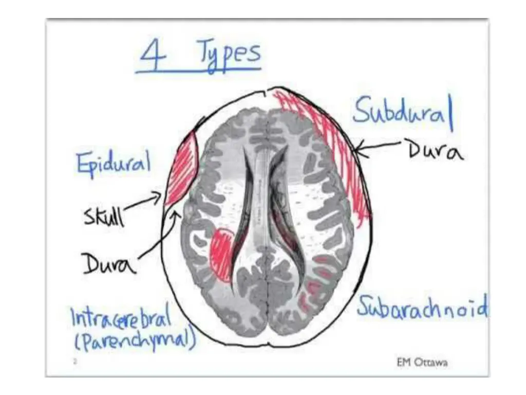 slide8