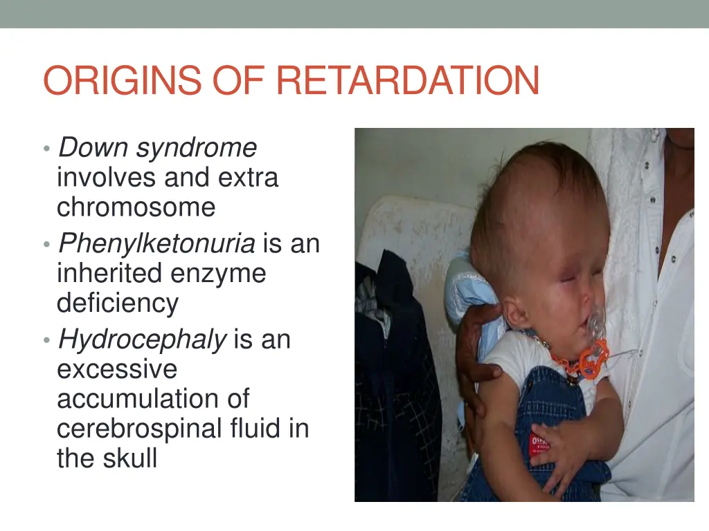 origins of retardation