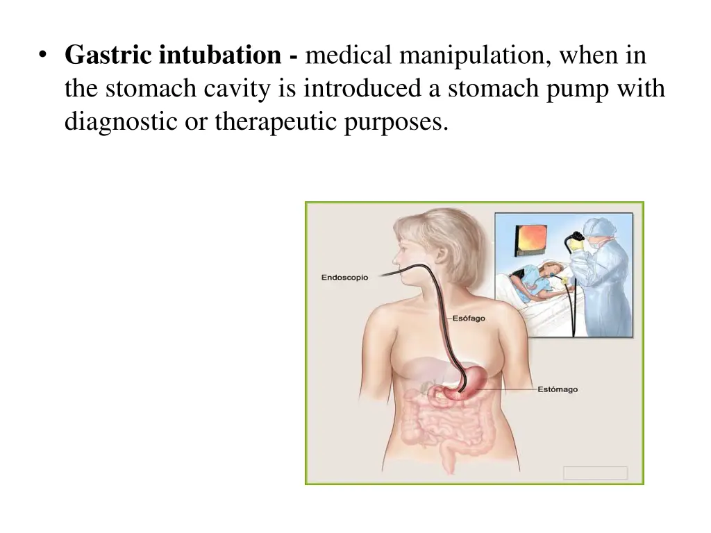 gastric intubation medical manipulation when