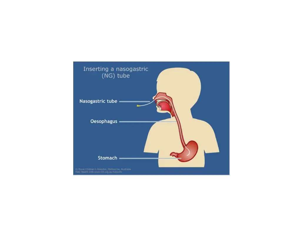 slide14