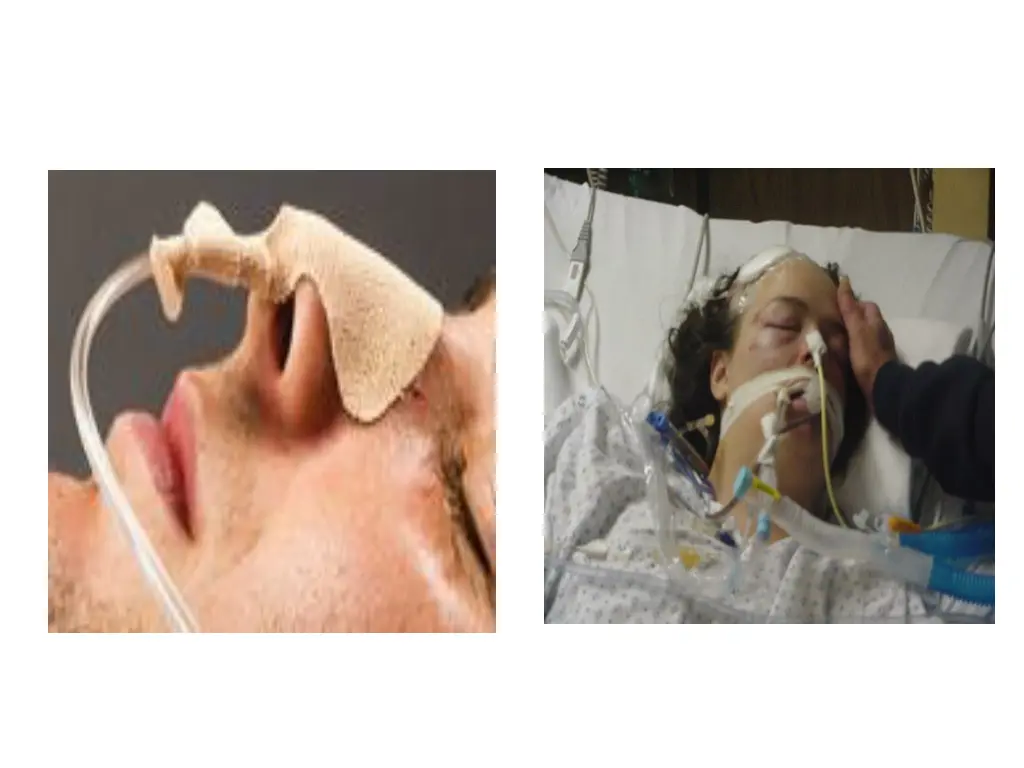 slide15