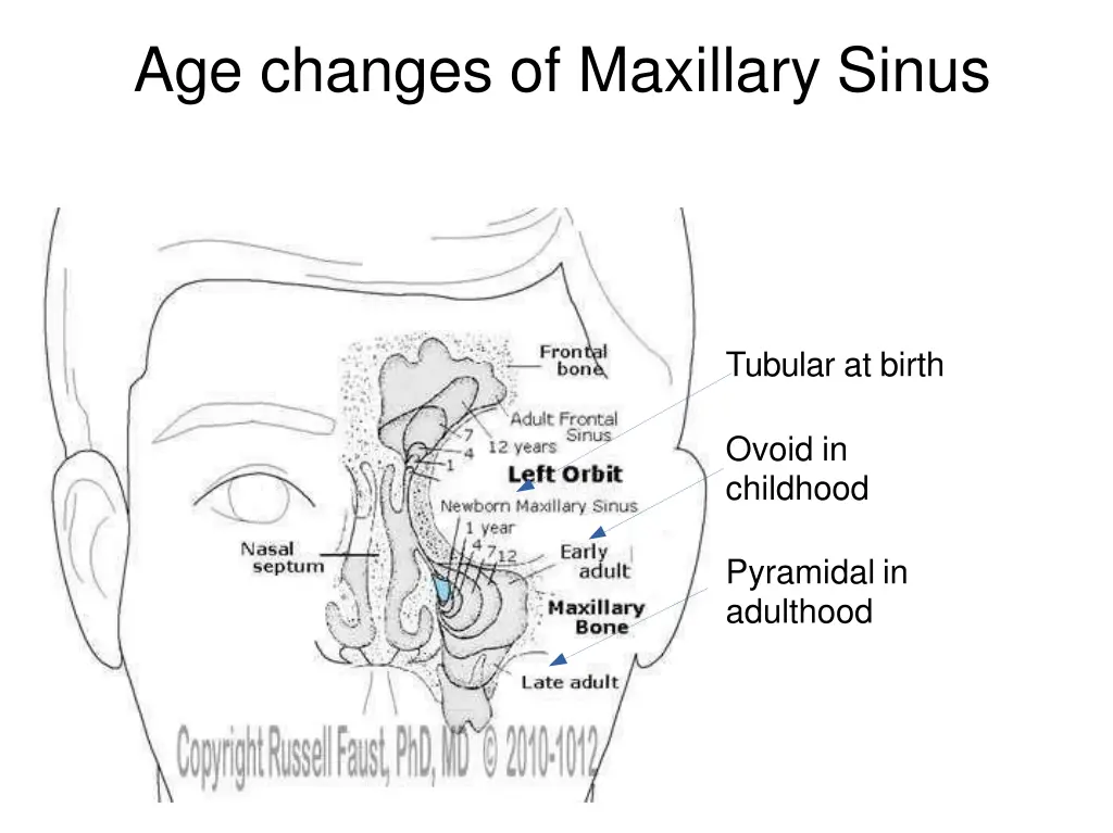 age changes of maxillary sinus