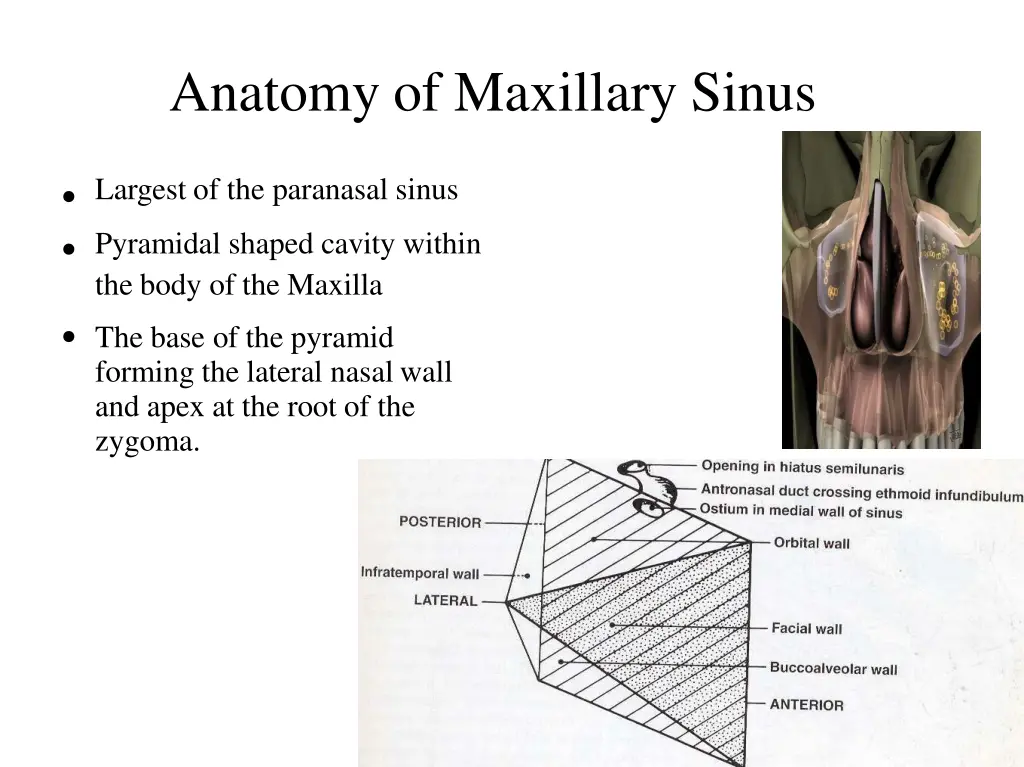 anatomy of maxillary sinus