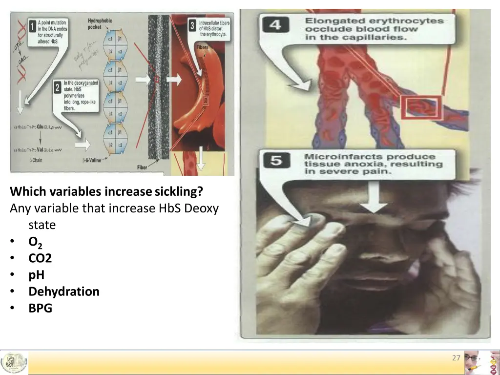 which variables increase sickling any variable