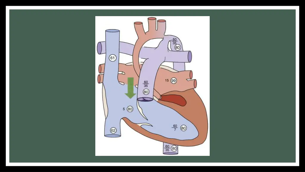 slide11