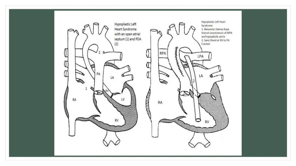 slide23