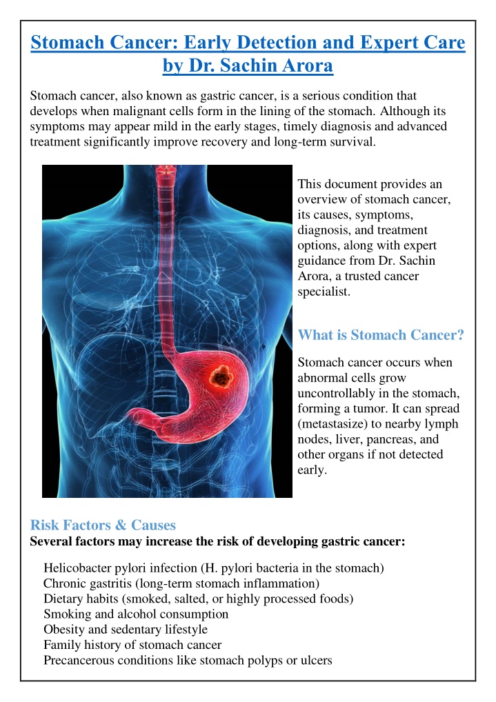 stomach cancer early detection and expert care
