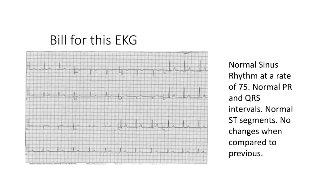 bill for this ekg