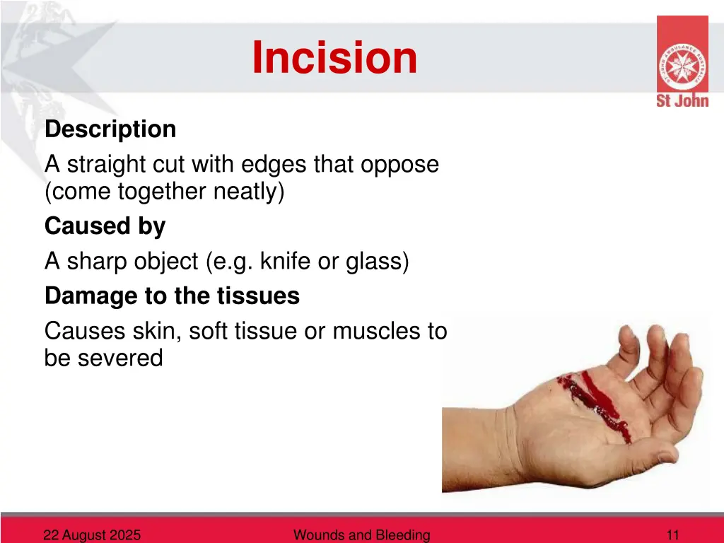 incision