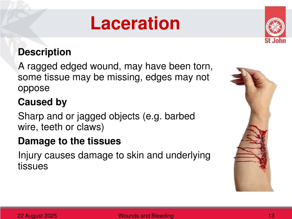 laceration