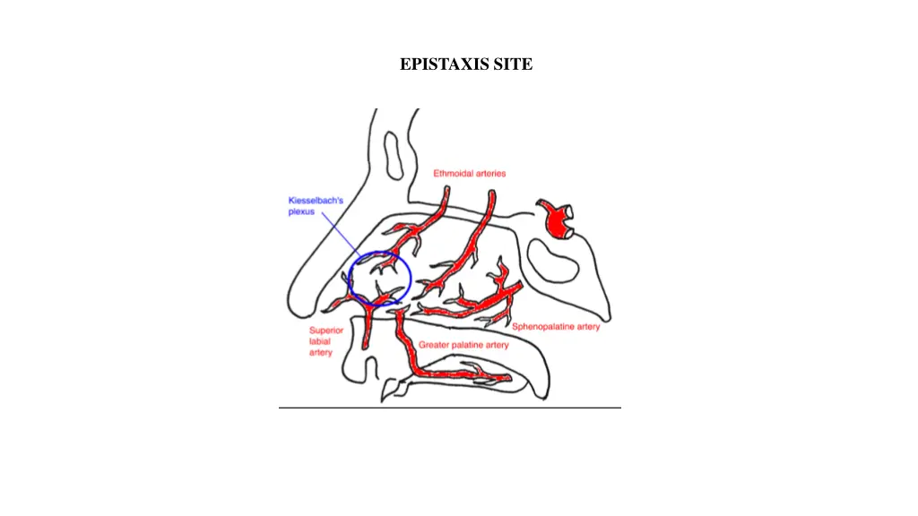 epistaxis site