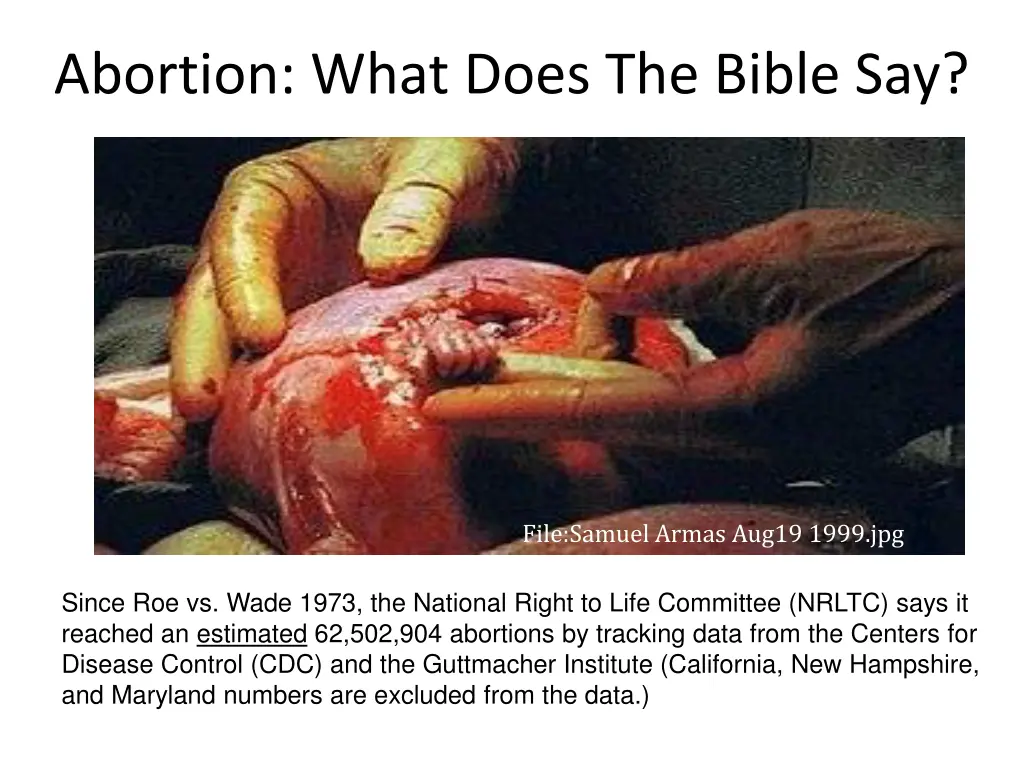 abortion what does the bible say