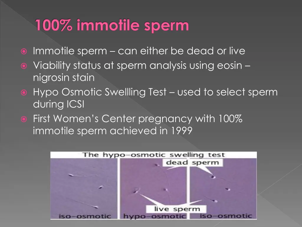 100 immotile sperm