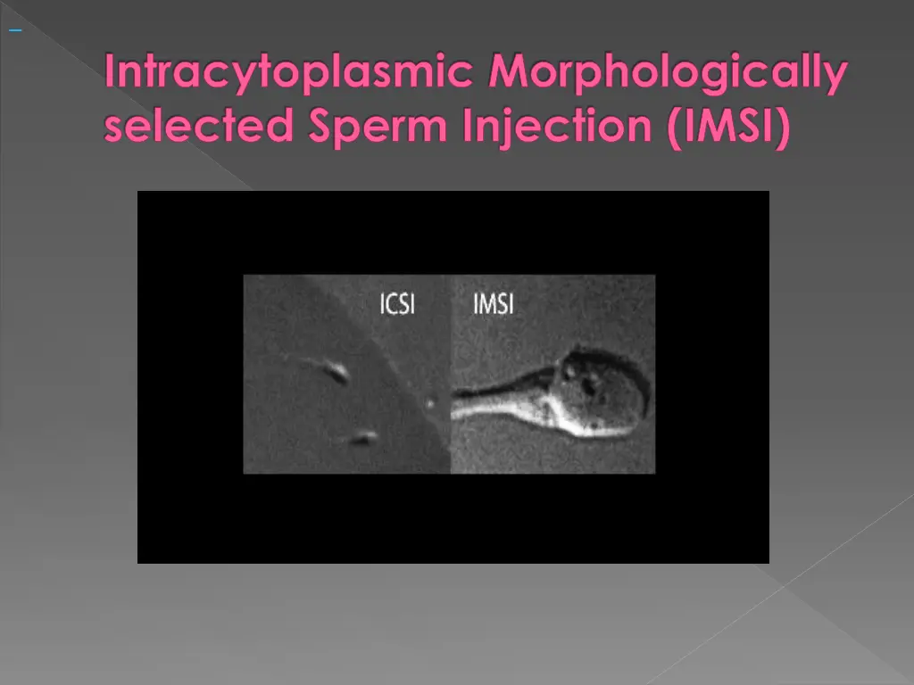 intracytoplasmic morphologically selected sperm