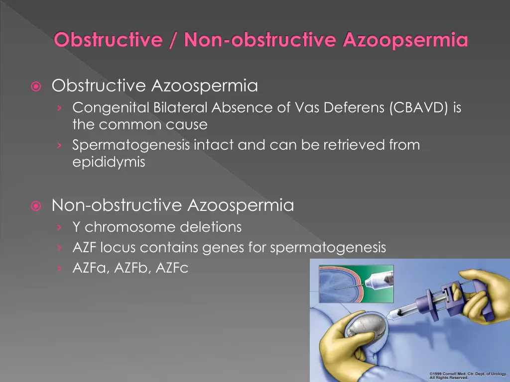 obstructive non obstructive azoopsermia