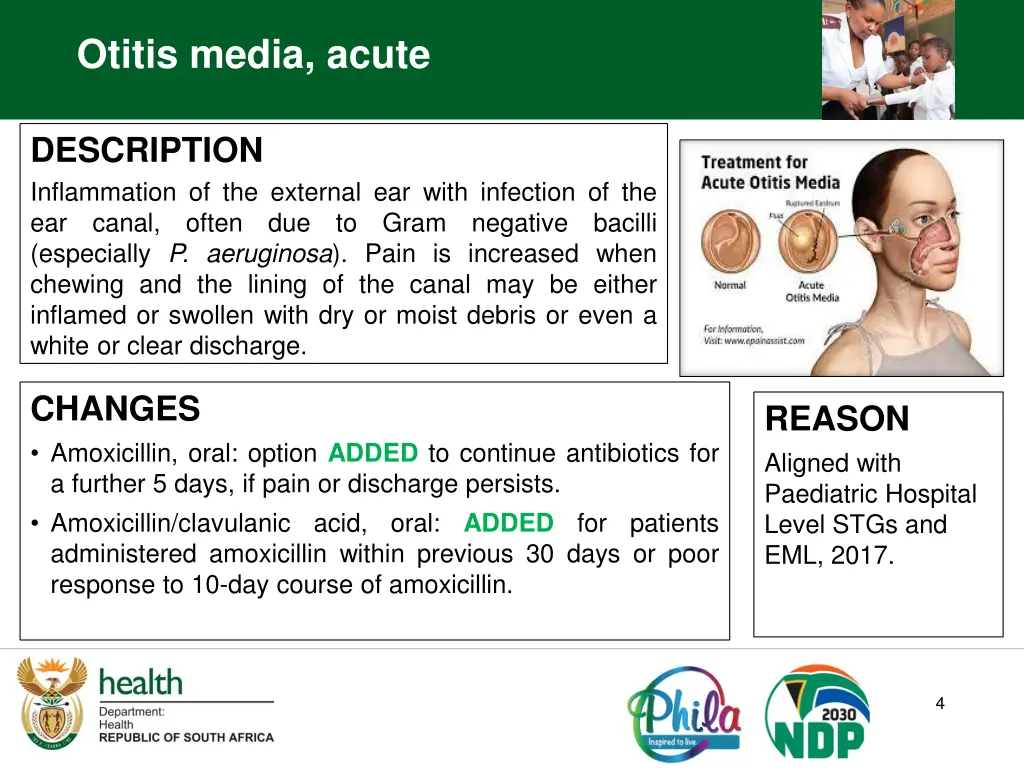 otitis media acute
