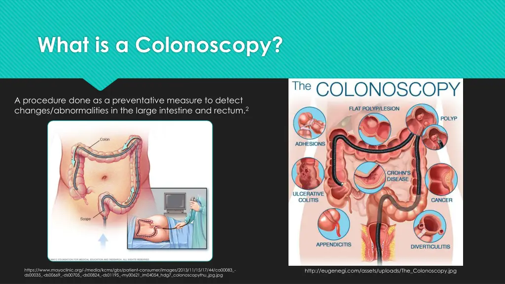 what is a colonoscopy