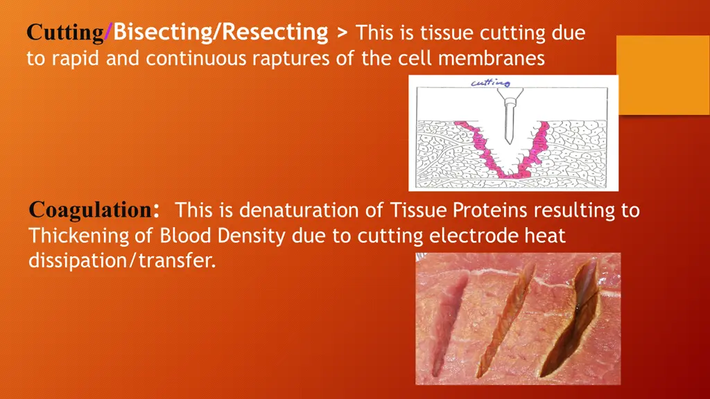 cutting bisecting resecting this is tissue