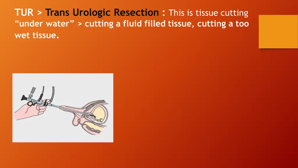 tur trans urologic resection this is tissue