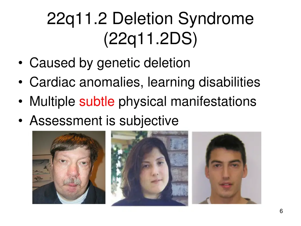 22q11 2 deletion syndrome 22q11 2ds caused