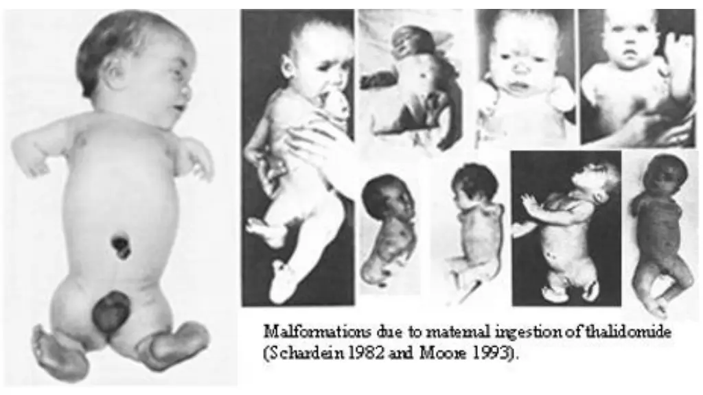 slide12