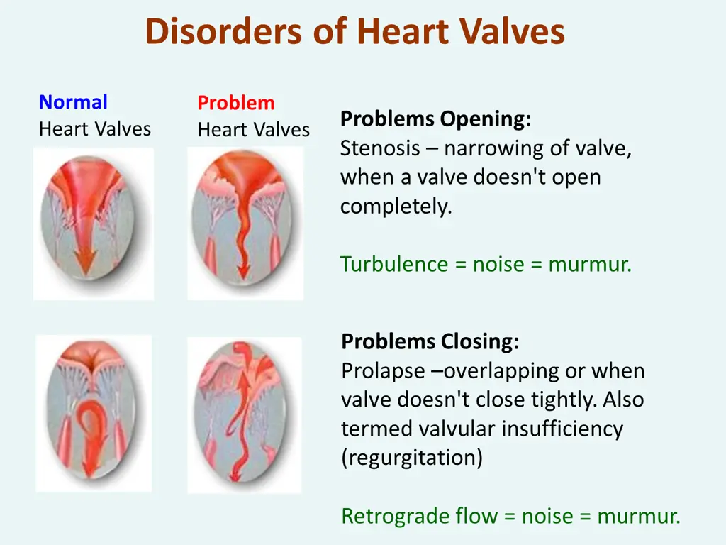 disorders of heart valves
