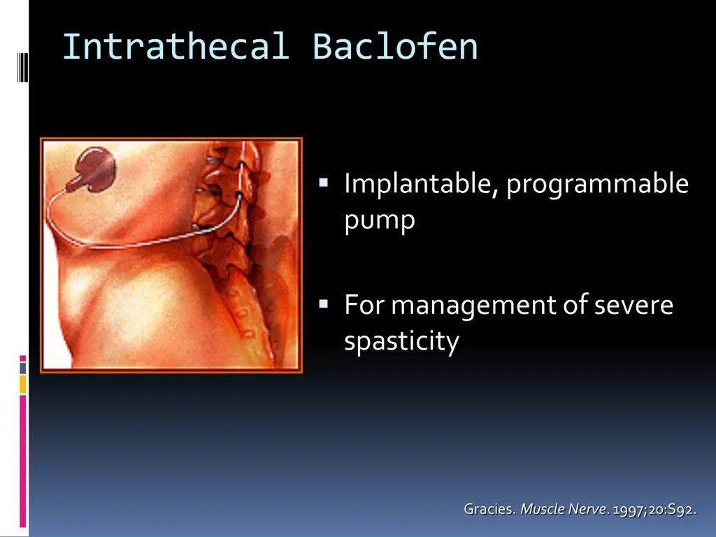 intrathecal baclofen