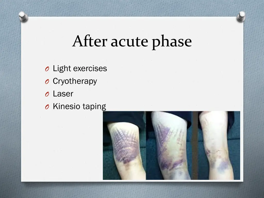 after acute phase