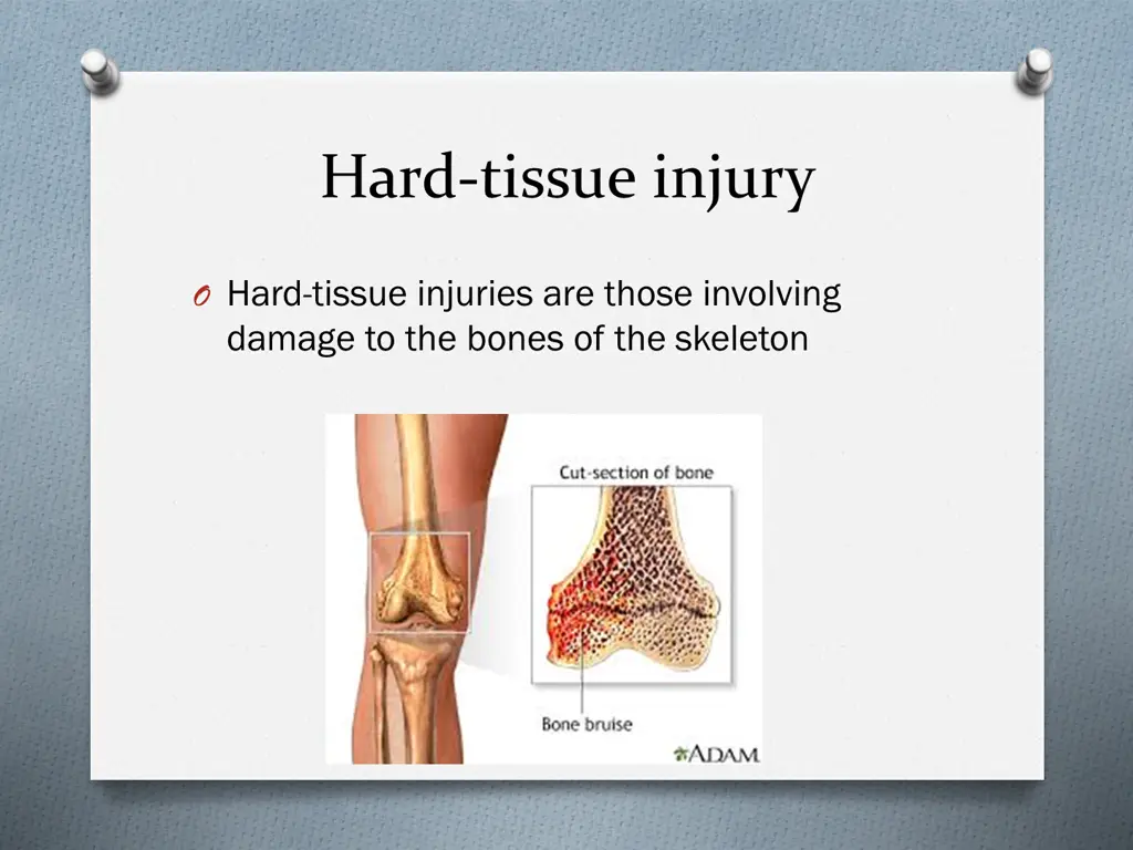 hard tissue injury