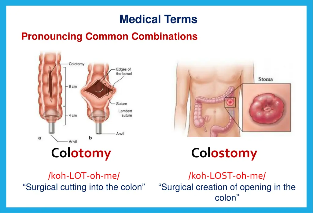 medical terms 11