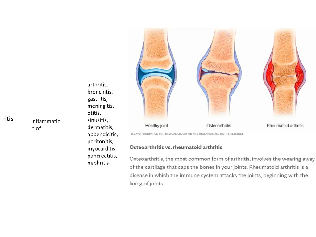 arthritis bronchitis gastritis meningitis otitis