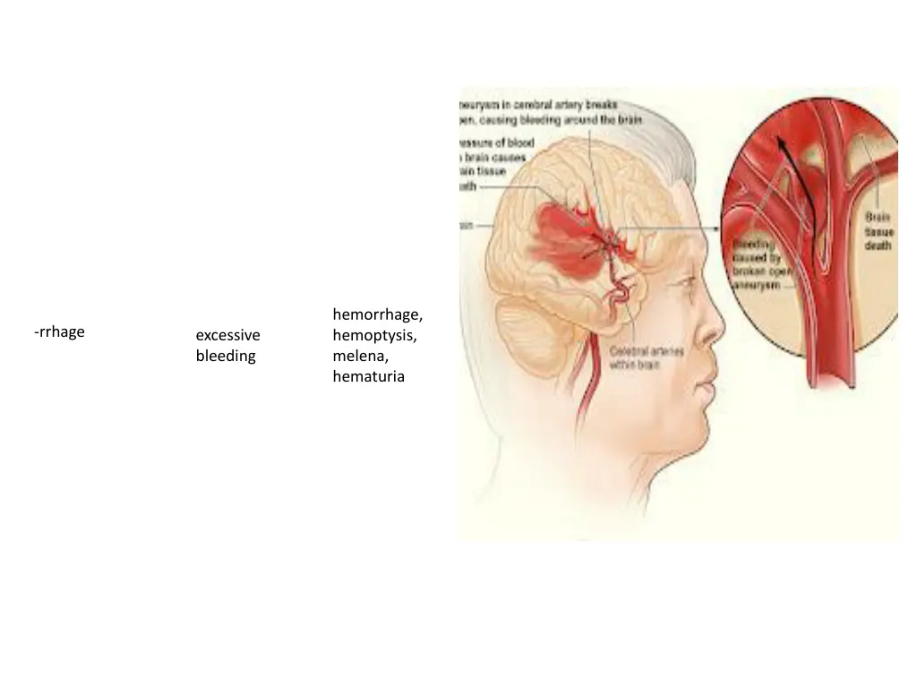 hemorrhage hemoptysis melena hematuria