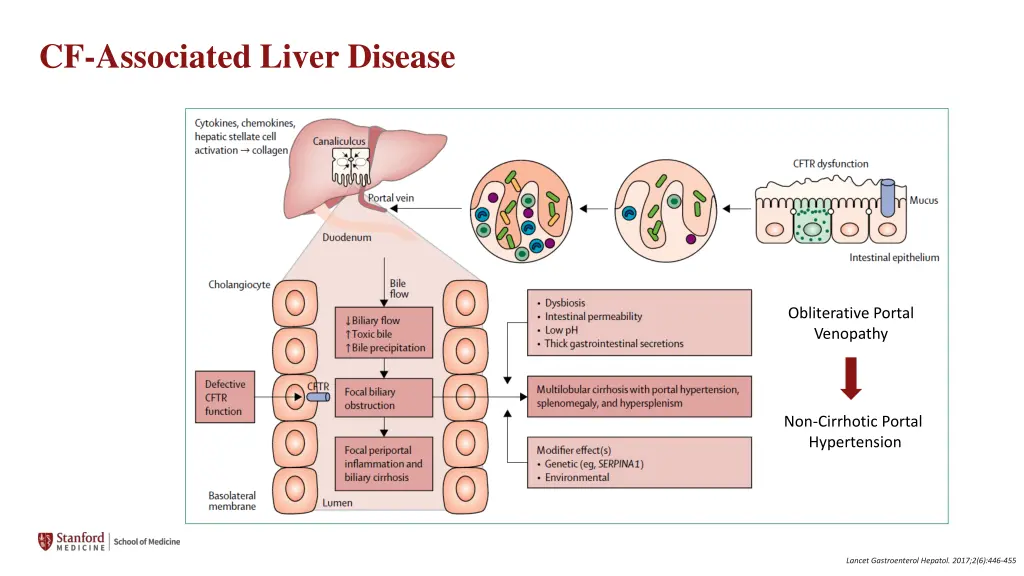 cf associated liver disease