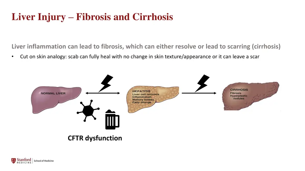 liver injury fibrosis and cirrhosis