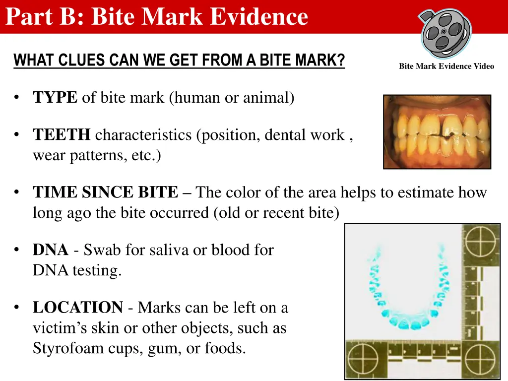 part b bite mark evidence