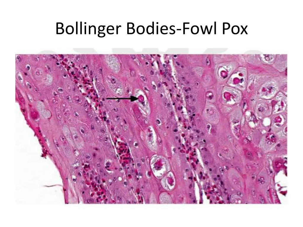 bollinger bodies fowl pox