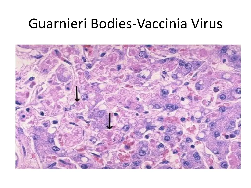 guarnieri bodies vaccinia virus