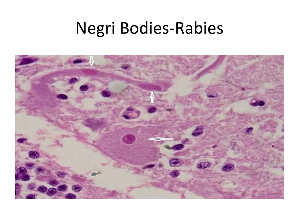 negri bodies rabies