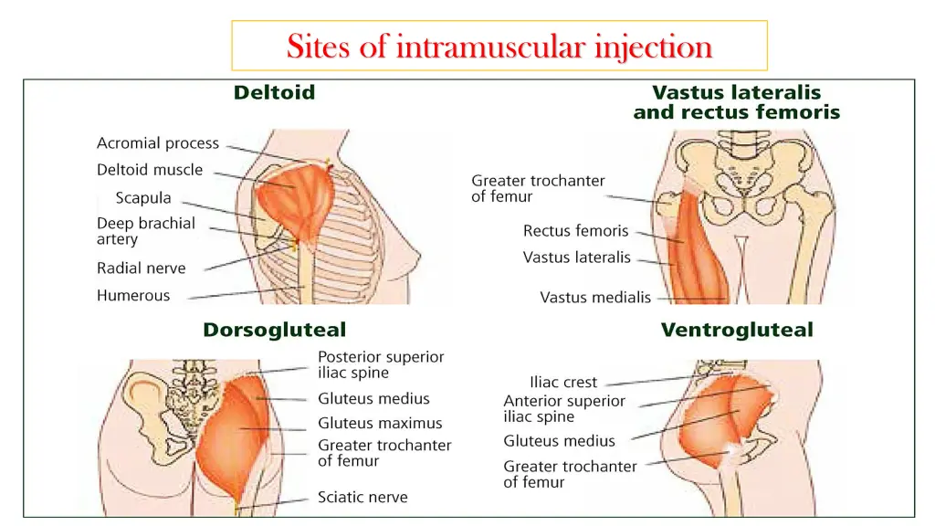 sites of intramuscular injection