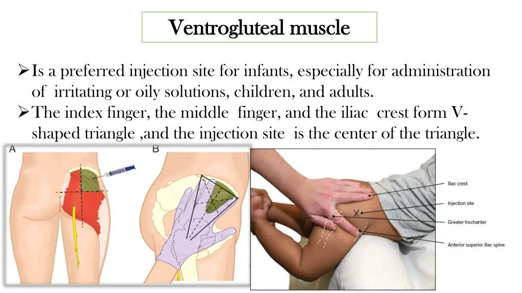 ventrogluteal ventrogluteal muscle 1