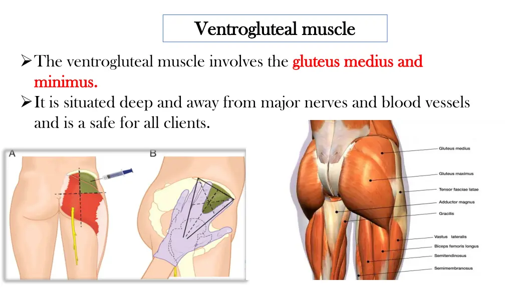 ventrogluteal ventrogluteal muscle