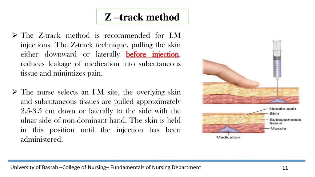 z track method