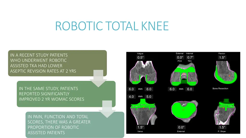 robotic total knee