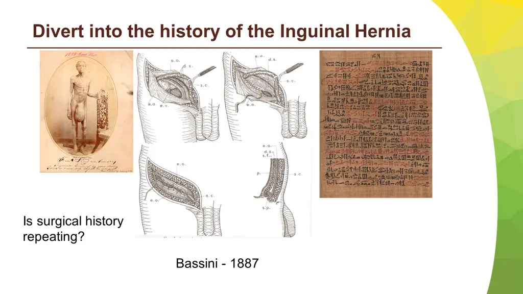 divert into the history of the inguinal hernia