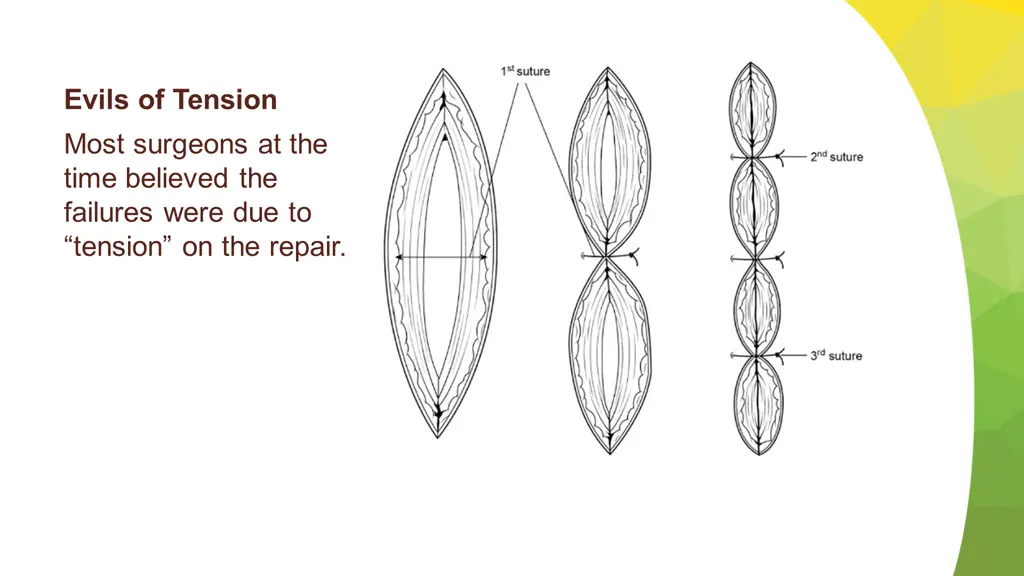 evils of tension most surgeons at the time