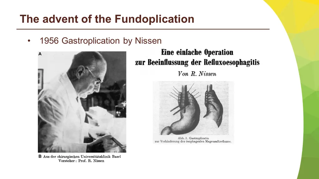 the advent of the fundoplication