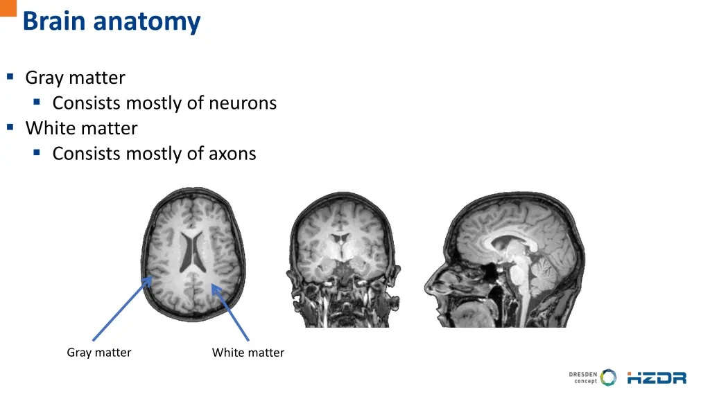 brain anatomy 1