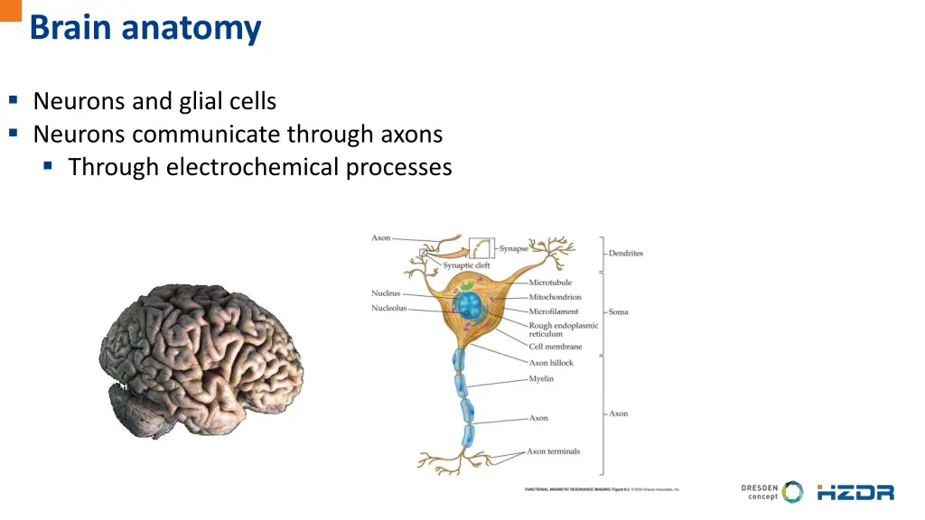 brain anatomy